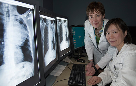 Researchers Laura Jean Bierut, MD (left), and Li-Shiun Chen, MD, examine X-rays of a patient with lung cancer. The two have found that smokers with a variation in a gene involved in processing nicotine are likely to keep smoking longer and develop cancer sooner than people who don’t have the gene variant.